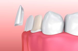 Teeth