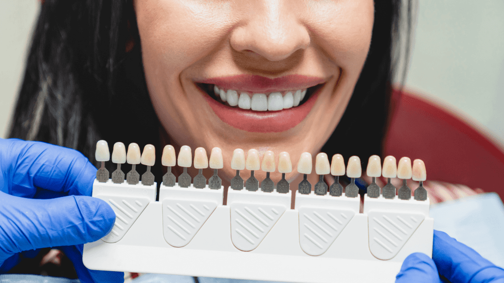 Veneers Vs Crowns