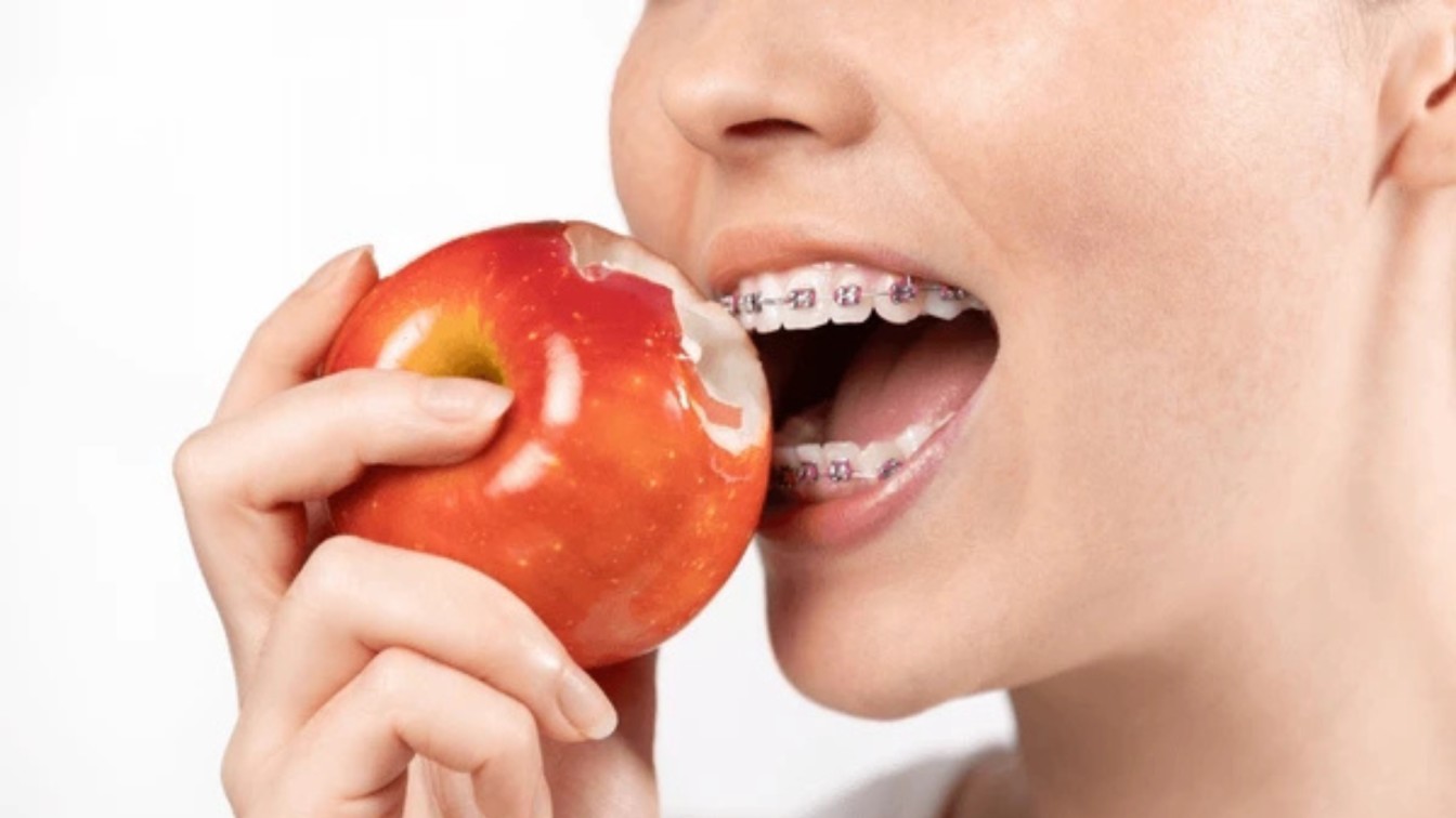 Eating with Braces
