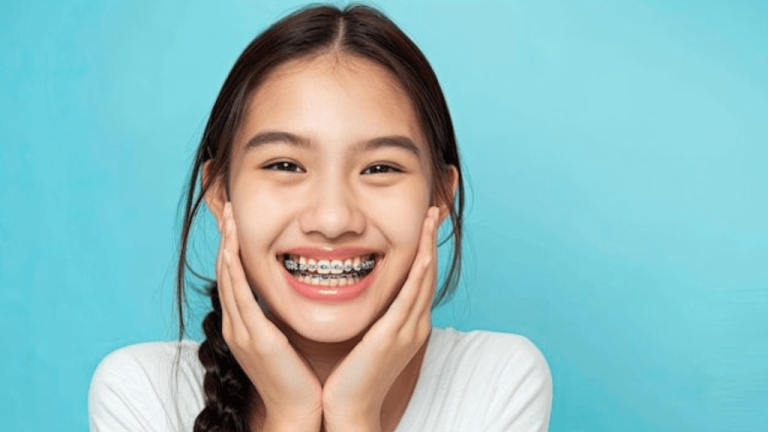 Braces