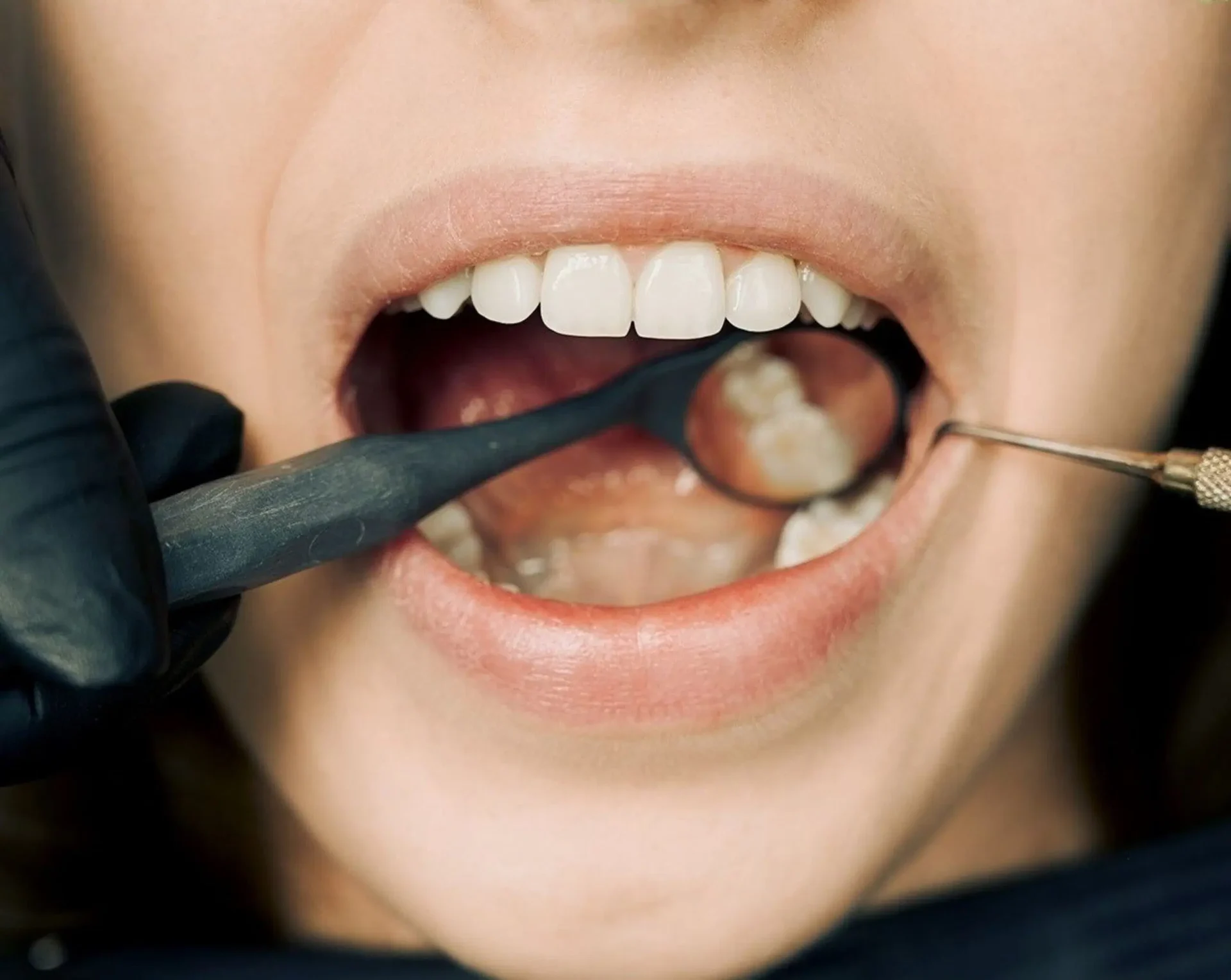 Dentist examining a patient's teeth and gums during a periodontal exam