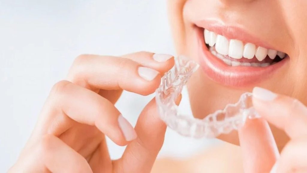 Invisalign