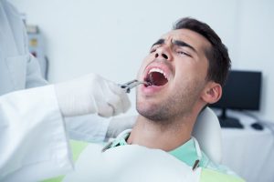 Tooth Extraction